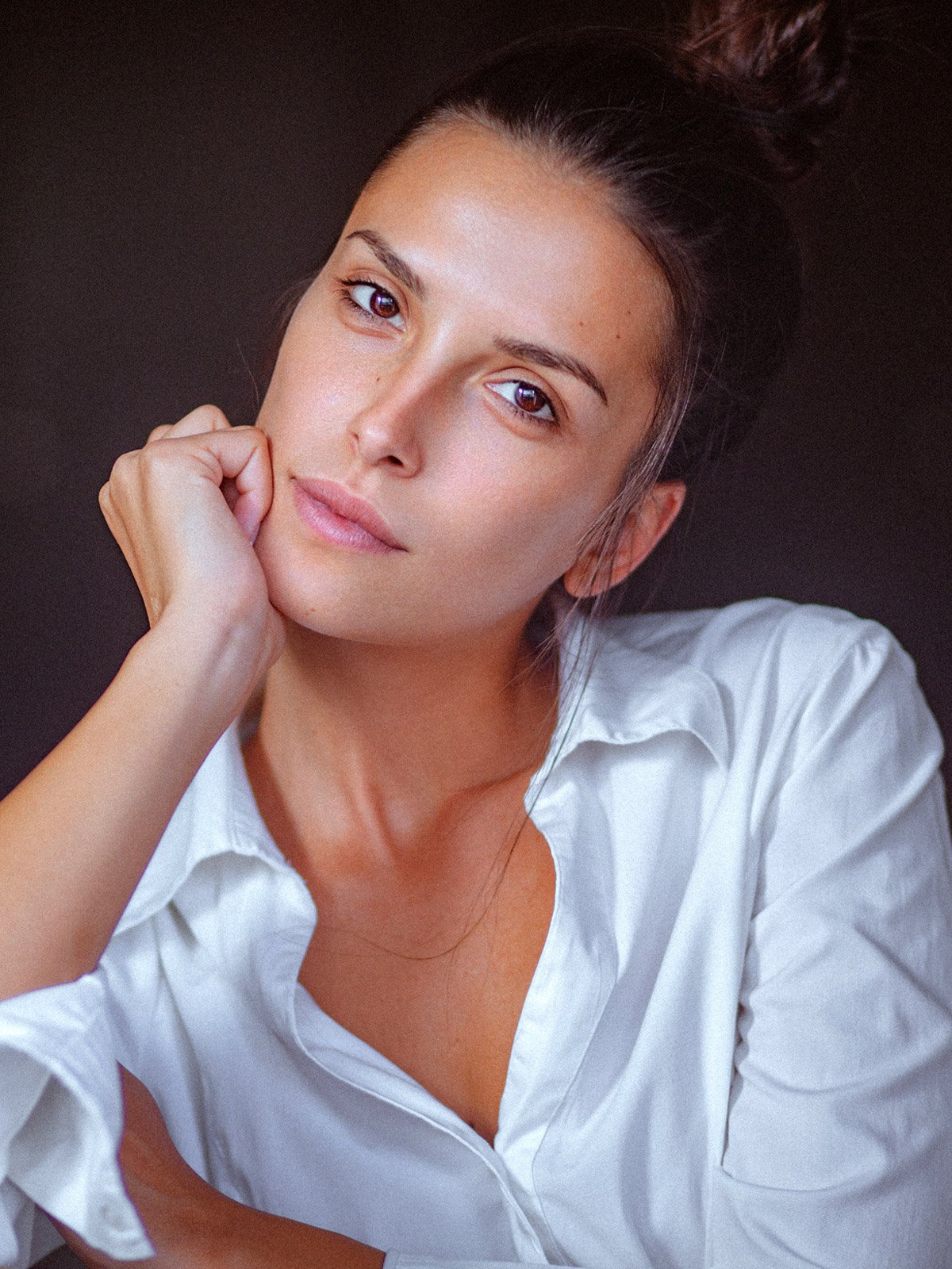boston juvederm patient model in a white button up shirt resting her head on her hand